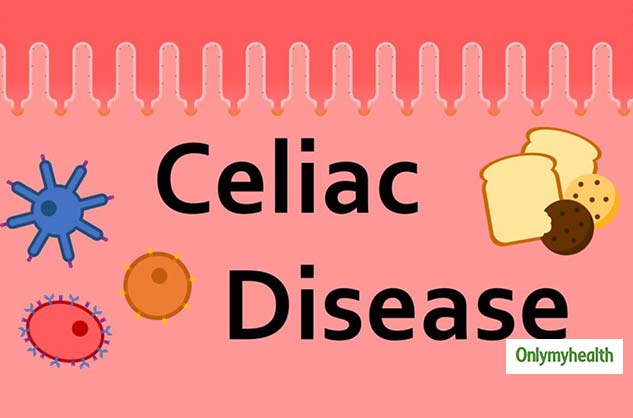 celiac disease