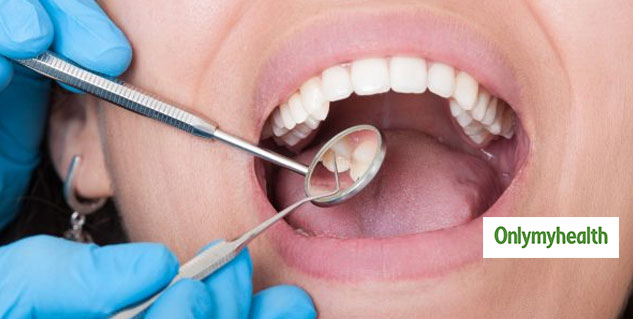 inside1_gumandteeth