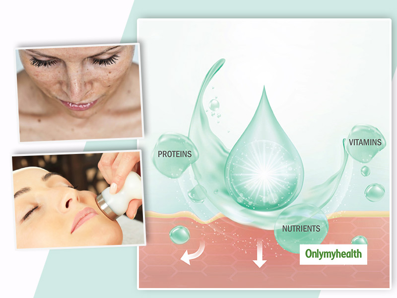 Mesotherapy For Facial Skin Rejuvenation Procedure Benefits And Side Effects