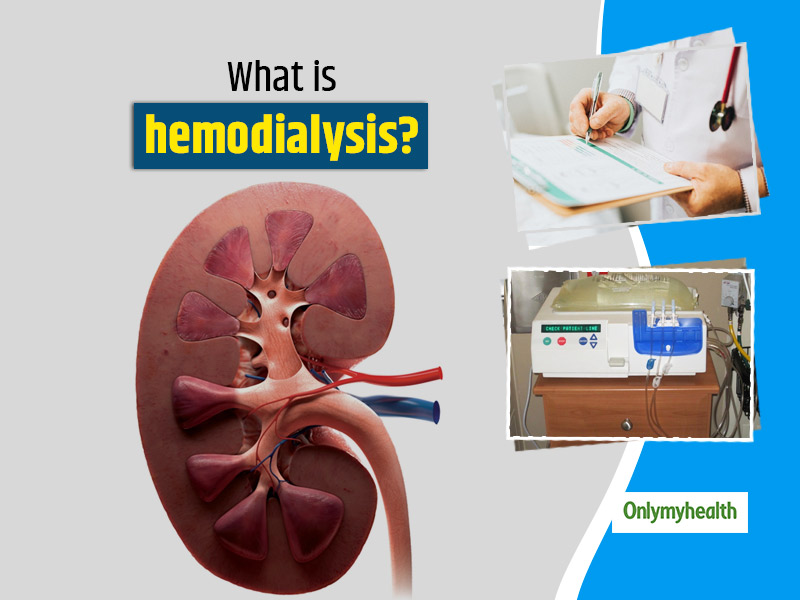All About Hemodialysis: Procedure, Complications, Advantages And Disadvantages