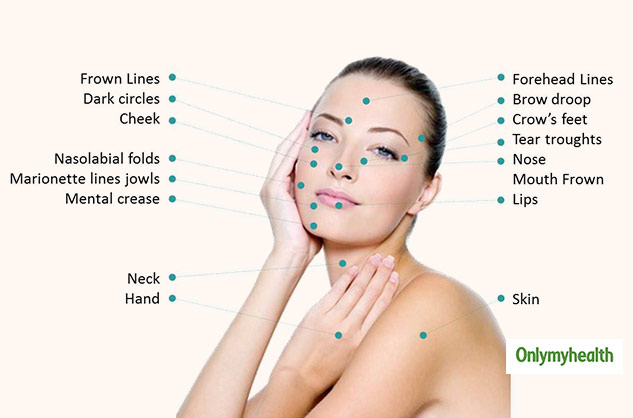 procedure of mesotherapy