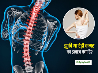 कमर में झुकाव या टेढ़ेपन का कारण हो सकती है स्पाइन (रीढ़) की समस्या, एक्सपर्ट से जानें इसका इलाज