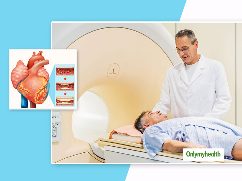 Coronary Calcium Scan: Know The Purpose And Risks Related To This Heart ...