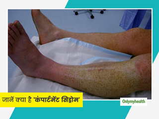 हाथ-पैर में असहनीय दर्द हो सकता है कंपार्टमेंट सिंड्रोम का संकेत, जानें इस रोग के लक्षण, कारण और घरेलू इलाज
