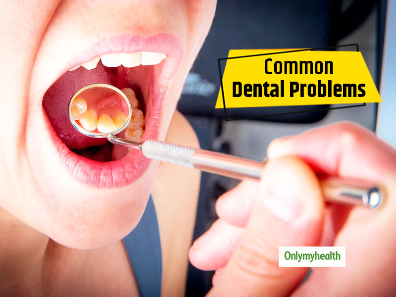 Know 5 Most Common Dental Issues & How To Tackle Them From Expert