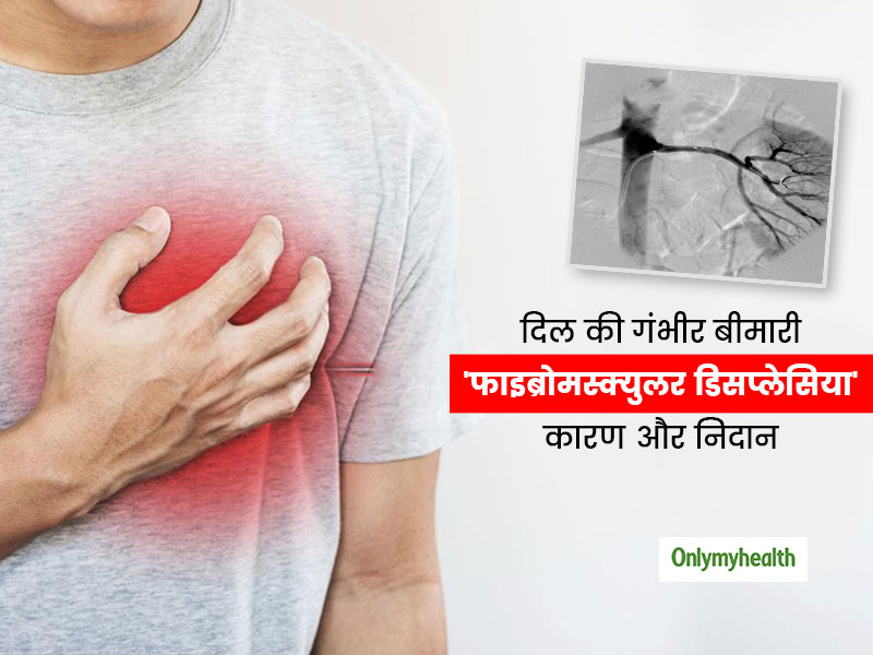 दिल से जुड़ी गंभीर बीमारी है  Fibromuscular Dysplasia, जानें इसके कारण और बचाव के उपाय