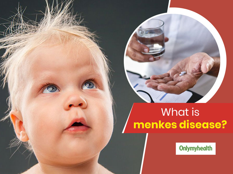 Menkes disease causes symptoms diagnosis treatment  prognosis