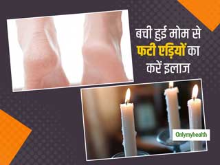 बची हुई मोमबत्तियों के मोम से दूर करें फटी एड़ियों की समस्या, जानें इस्तेमाल करने का तरीका