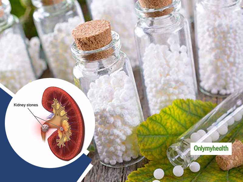 Nephrolithiasis: Dr Jyoti Sharma Shares Homeopathic Remedies To Treat Kidney Stones