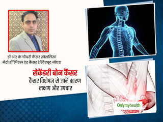 कैंसर बढ़ते हुए जब हड्डियों तक पहुंच जाए तो 'सेकेंडरी बोन कैंसर' कहलाता है, जानें इसके लक्षण, कारण और इलाज
