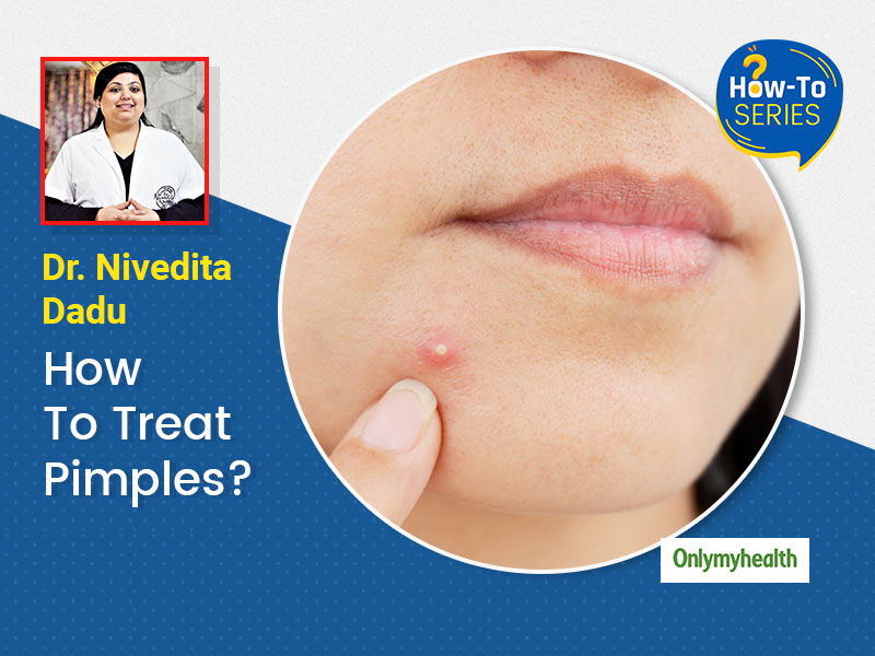 How To Get Rid of Pimples Fast? Dermatologist Shares Tips