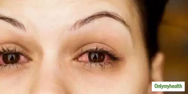 eye problems
