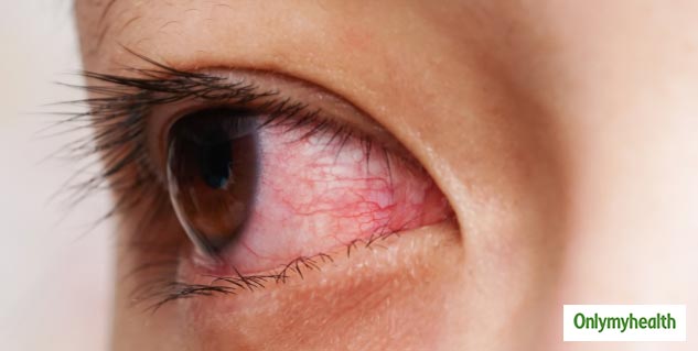 eye problems