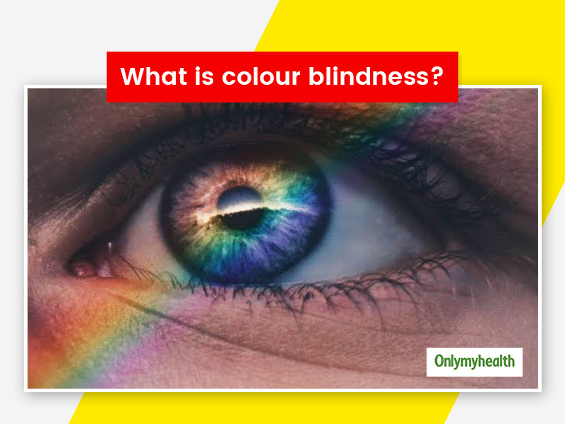 What are the causes of color blindness Home Design Ideas