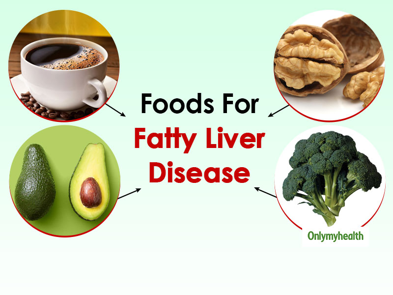 Do You Have Fatty Liver Disease? You Must Try Fatty Liver Diet