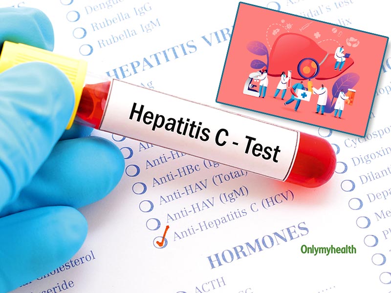 Follow These 5 Vital Tips To Keep Hepatitis C At Bay