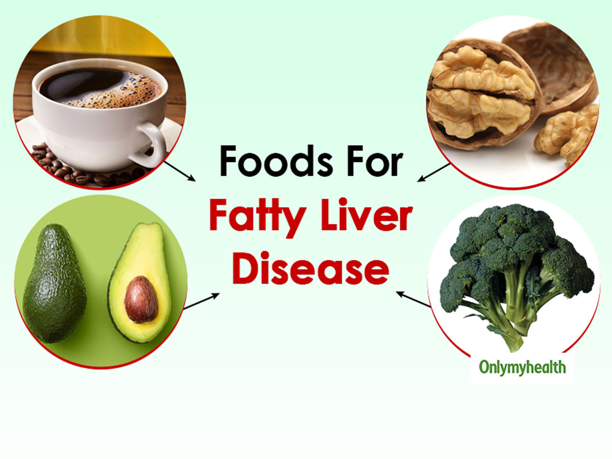 Do You Have Fatty Liver Disease? You Must Try Fatty Liver Diet - Do You  Have Fatty Liver Disease? You Must Try Fatty Liver Diet