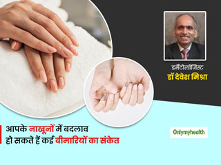 नाखूनों के रंग और शेप में बदलाव हो सकते हैं कई बीमारियों का संकेत, जानें Nail Disorders के बारे में