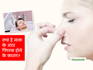 नाक के अंदर क्यों हो जाते हैं फुंसी या पिंपल्स? जानिए इससे छुटकारा पाने के घरेलू उपाय
