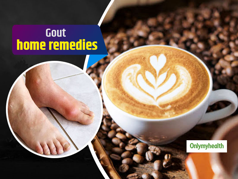 how to treat gout at home