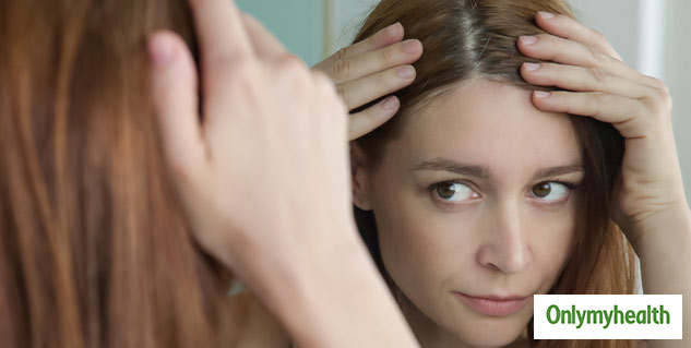 insidehairloss