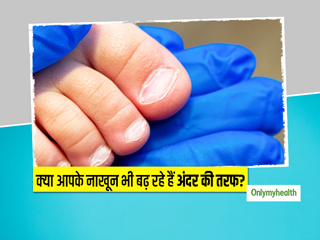 नाखून के आसपास सूजन हो सकते है नाखूनों के अंदर बढ़ने का संकेत, जानें कारण और इलाज
