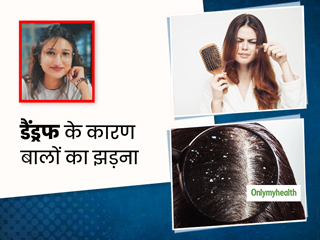 डैंड्रफ (रूसी) के कारण कमजोर होकर क्यों झड़ने लगते हैं बाल? एक्सपर्ट से जानें कारण और डैंड्रफ दूर करने के उपाय