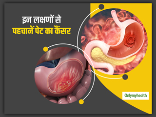 क्यों होता है पेट का कैंसर और क्या हैं इसके शुरुआती संकेत? डॉक्टर से जानें पेट के कैंसर के लक्षण और इलाज