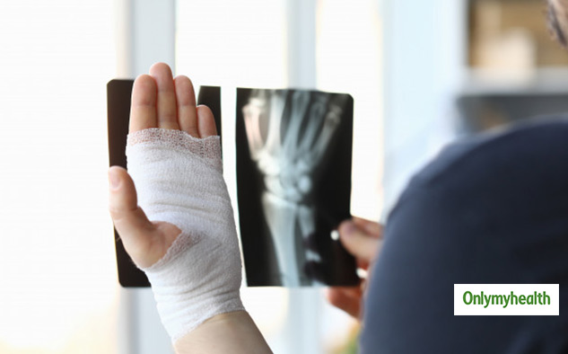 avoid things during fracture