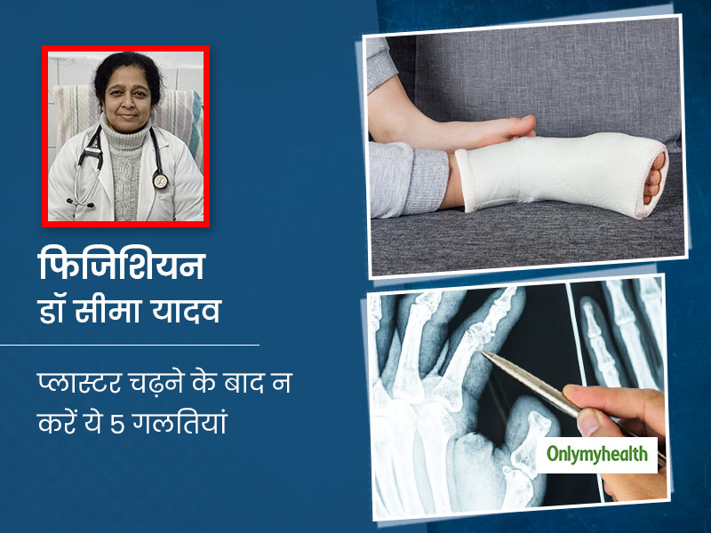 कई बार हो चुका है हड्डियों में फ्रैक्चर तो ध्यान रखें ये 5 बातें, प्लास्टर चढ़ने के बाद कभी न करें ये गलतियां