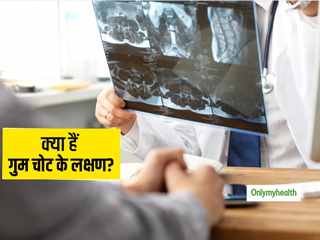 गुम चोट क्या है और कैसे पहचानें इसे? एक्सपर्ट से जानें गुम चोट के लक्षण, कारण और बचाव के तरीके
