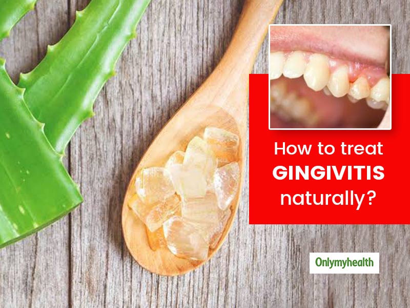 How To Treat Gingivitis Naturally Here Are 8 Effective Home Remedies