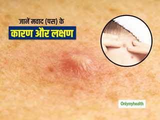 इन 8 कारणों से शरीर पर बन सकता है मवाद, जानें इसके लक्षण और बचाव