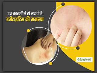 स्किन पर खुजली, रैशेज और सूजन हो सकते हैं डर्मेटाइटिस का संकेत, एक्सपर्ट से जानें इसके कारण, लक्षण और बचाव