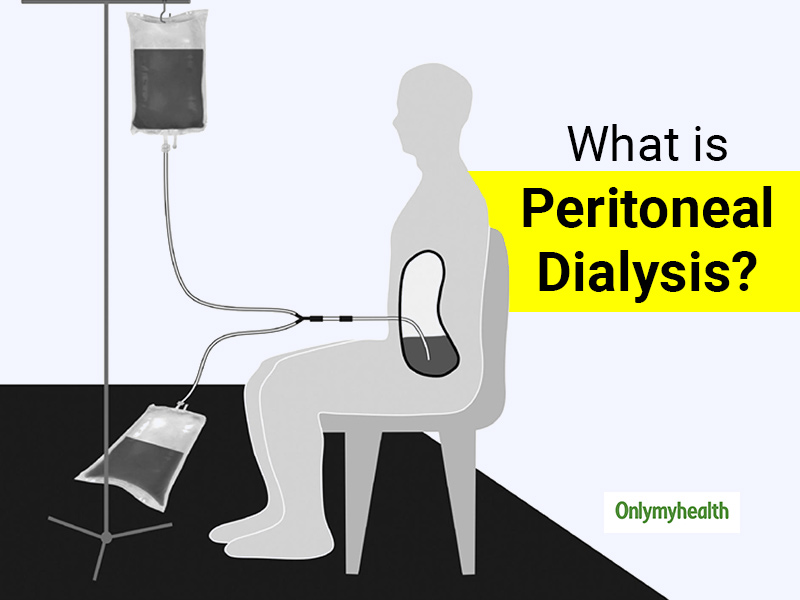 Peritoneal Dialysis (PD): Everything About Its Need, Risks And Side ...