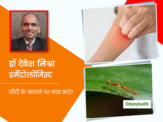 चींटी काटने पर होने वाले जलन और सूजन से पाएं निजात, इस्तेमाल करें ये 9 घरेलू उपाय