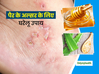 पैर के अल्सर के लिए असरदार है यह 10 आयुर्वेदिक उपचार, एक्सपर्ट से जानिए इस्तेमाल का आसान तरीका