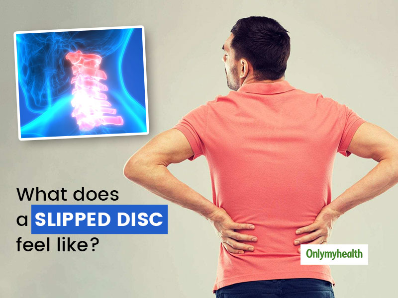 Slipped Disc Treatment, Symptoms & Causes