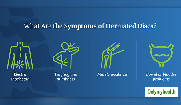 Herniated Disc : Symptoms, Causes, Treatments and Prevention