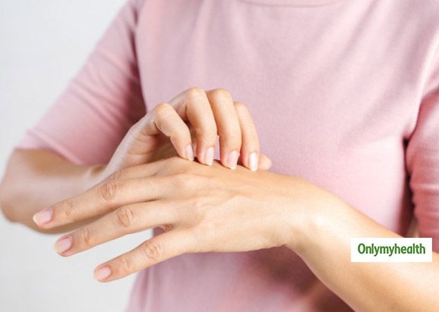 dry hands in winters