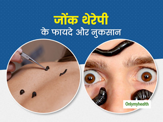 Leech Therapy: ब्लड सर्कुलेशन को बेहतर बनाती है लीच थेरेपी, जानें इसके 7 फायदे और कुछ नुकसान