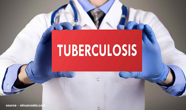 TB Myths and Facts