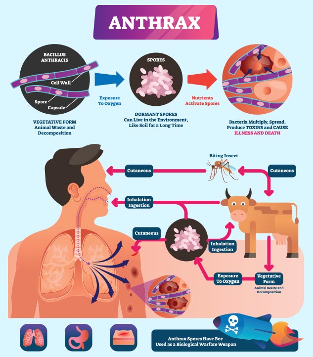 symptoms-causes-and-risk-factors-for-anthrax-bacterial-infection