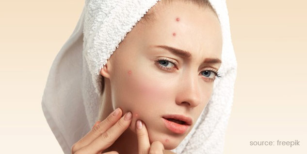 Inside3pimples