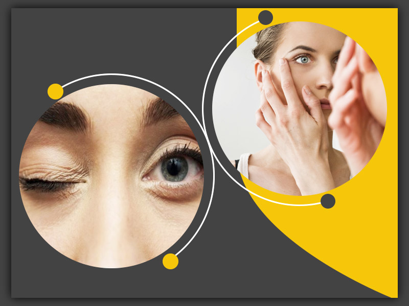 Experiencing Eye Twitching Know Common Causes And Triggers Of Eyelid Twitching Onlymyhealth 