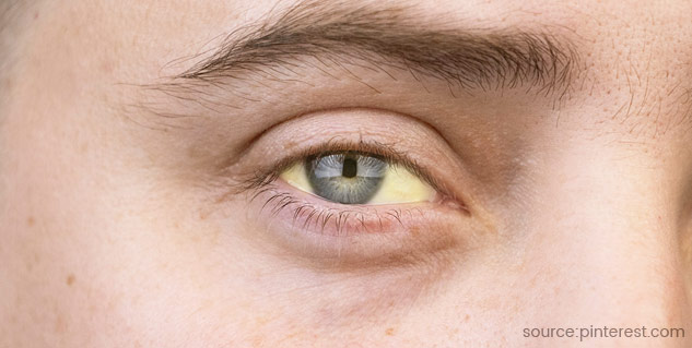 Inside2_blackjaundice