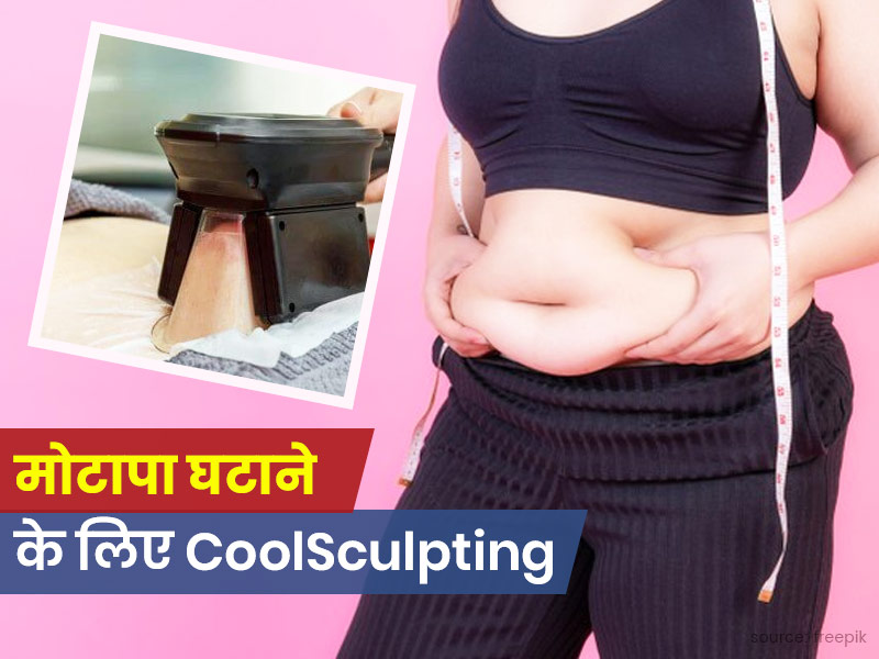 मोटापा कम करने का नया तरीका है कूलस्कल्पटिंग (CoolSculpting), जानें क्या है ये और इसके फायदे