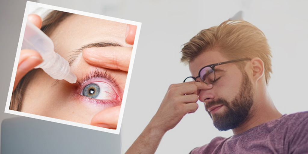 Corneal Inflammation Keratitis Causes Symptoms And Treatment In Hindi आ ख म दर द ल ल म और थक न ह सकत ह क र ट इट स क समस य क स क त ज न इसक ब र म Onlymyhealth