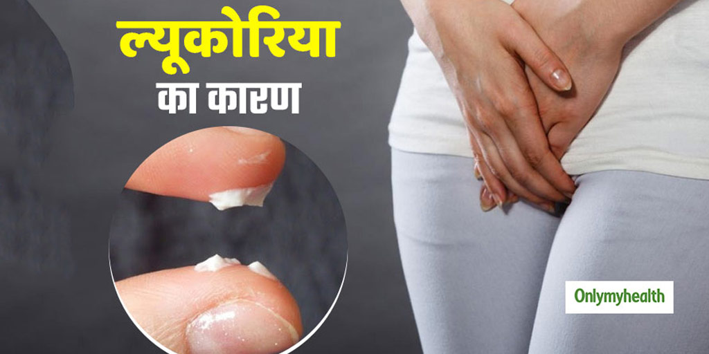 Leukorrhea Causes And Symptoms In Hindi 