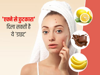 मुंहासों से छुटकारा पाना चाहते हैं तो डाइट में शामिल करें ये 9 चीजें